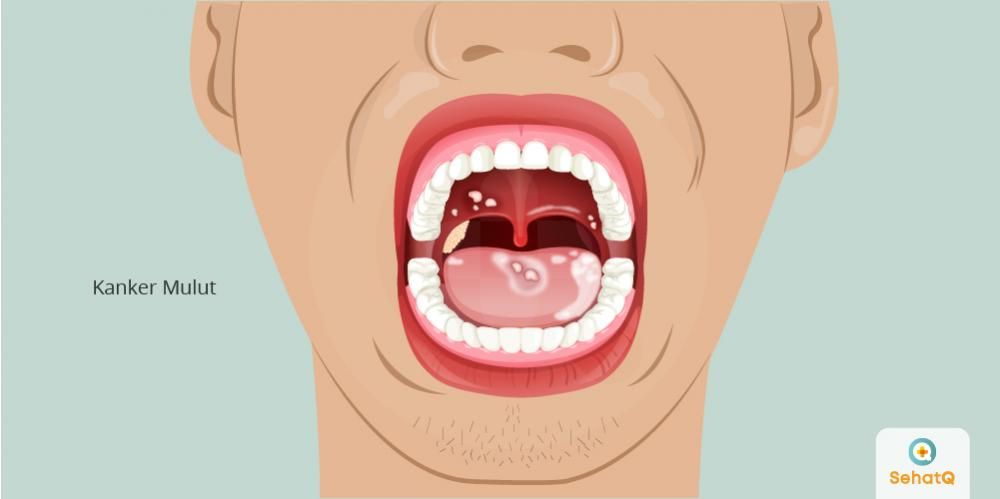 gambar anggota tubuh mulut